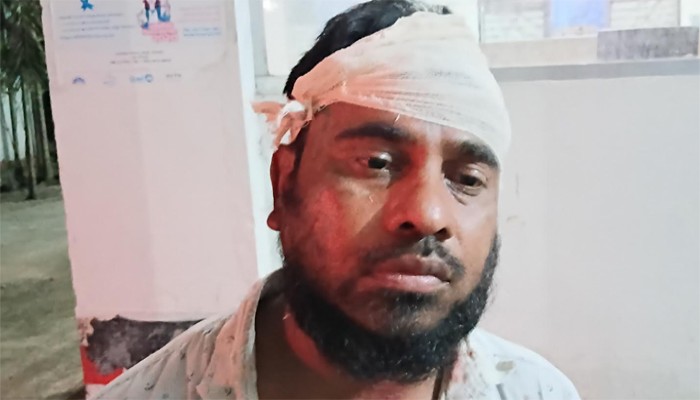 সিংড়ায় মসজিদ কমিটির বিরোধের জেরে প্রতিপক্ষের হামলায় আহত-৪, থানায় অভিযোগ সিংড়ায় মসজিদ কমিটির বিরোধের জেরে প্রতিপক্ষের হামলায় আহত-৪, থানায় অভিযোগ