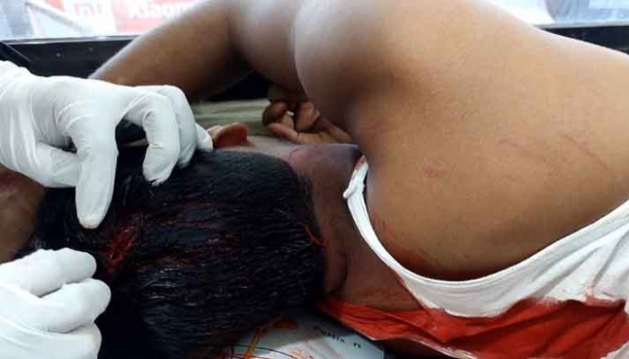 মির্জাপুরে চলন্ত ট্রেনে মোবাইল ছিনতাই যাত্রী পড়ে আহত মির্জাপুরে চলন্ত ট্রেনে মোবাইল ছিনতাই যাত্রী পড়ে আহত