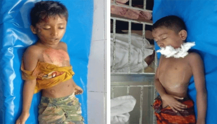 নোয়াখালীতে অটোরিকশা চাপায় দুই শিশু শিক্ষার্থীর মৃত্যু নোয়াখালীতে অটোরিকশা চাপায় দুই শিশু শিক্ষার্থীর মৃত্যু