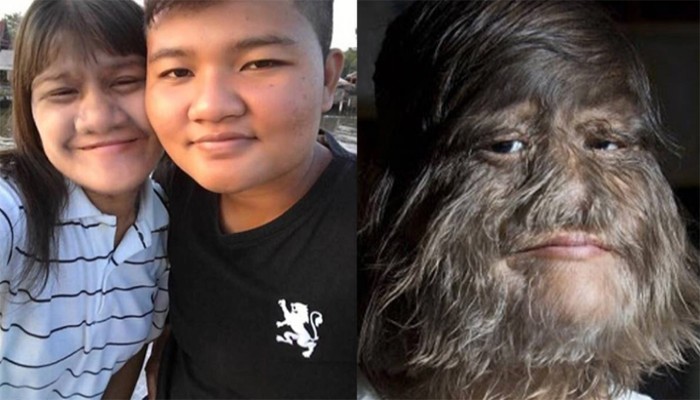 প্রেমিক জুটছিল না, ওখানে' শেভ করে তাক লাগিয়ে দিলেন বিশ্বের সবচেয়ে 'লোমশ সুন্দরী' প্রেমিক জুটছিল না, ওখানে' শেভ করে তাক লাগিয়ে দিলেন বিশ্বের সবচেয়ে 'লোমশ সুন্দরী'