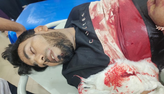 চাঁদা না পেয়ে প্রবাসীর হাতের কবজি কাটল সন্ত্রাসীরা চাঁদা না পেয়ে প্রবাসীর হাতের কবজি কাটল সন্ত্রাসীরা
