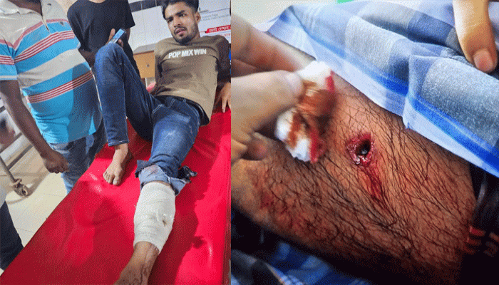 খেলা দেখা নিয়ে দ্বন্দ্ব: নোয়াখালীতে যুবদল কর্মির গুলিতে জামায়াতের ২কর্মি গুলিবিদ্ধ খেলা দেখা নিয়ে দ্বন্দ্ব: নোয়াখালীতে যুবদল কর্মির গুলিতে জামায়াতের ২কর্মি গুলিবিদ্ধ