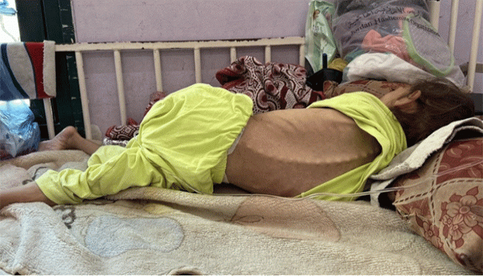 গাজায় মানবিক সহায়তা বাড়াতে বিশ্বকে আহ্বান জানালো ডব্লিউএইচও গাজায় মানবিক সহায়তা বাড়াতে বিশ্বকে আহ্বান জানালো ডব্লিউএইচও