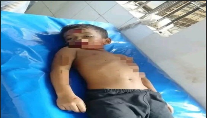 রাণীনগরে অটোভ্যানের ধাক্কায় প্রাণ গেল শিশুর রাণীনগরে অটোভ্যানের ধাক্কায় প্রাণ গেল শিশুর