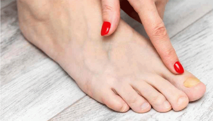 কী ভাবে বুঝবেন শরীরে ক্যানসার বাসা বেঁধেছে কি না কী ভাবে বুঝবেন শরীরে ক্যানসার বাসা বেঁধেছে কি না