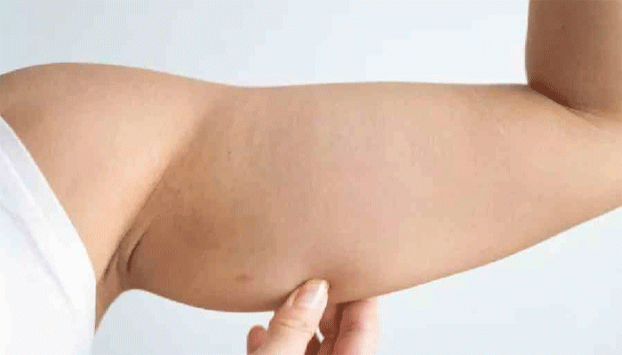 বাহুতে শিথিল হয়ে যাওয়া মাংসপেশি টানটান রাখতে ৫ খাবার খান নিয়মিত বাহুতে শিথিল হয়ে যাওয়া মাংসপেশি টানটান রাখতে ৫ খাবার খান নিয়মিত