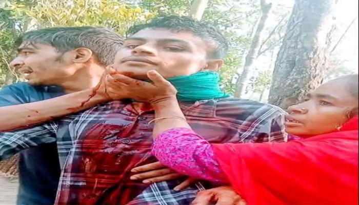 পারিবারিক কলহের জেরে যুবকের আত্মহত্যার চেষ্টা: নিজের লিঙ্গ কর্তন ও গলা কাটার ঘটনা, রংপুর হাসপাতালে প্রেরণ