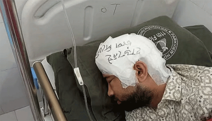 ফ্রিজে রাখা খুলি দুই মাস পর লাগানো হলো মামুনের মাথায়