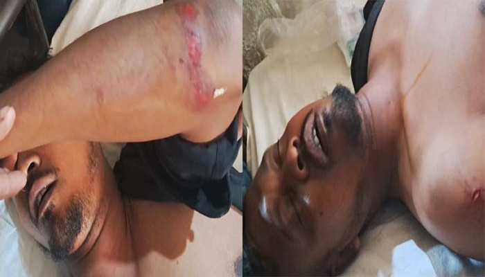 নোয়াখালীতে ফুটবল খেলাকে কেন্দ্র করে বিএনপির দুই গ্রুপের সংঘর্ষ, আহত ৫