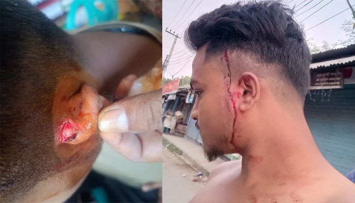 মতিহারে ঘরে ঢুকে টাকা চুরি ! চিনে ফেলায় যুবককে রড দিয়ে পিটিয়ে জখম