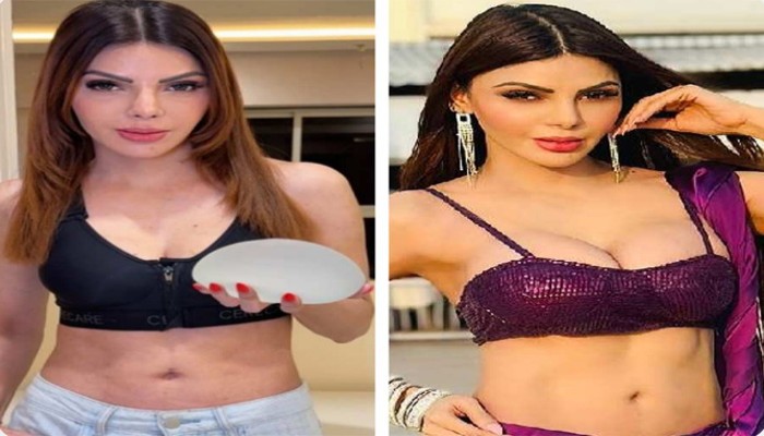 অস্ত্রোপচারের মাধ্যমে নকল স্তন সরিয়েছেন শার্লিন, এ বার কোন ভুলের কথা জানালেন তিনি?