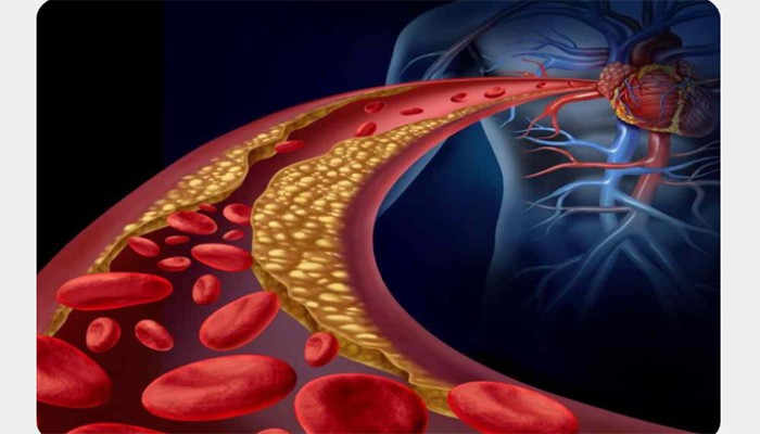 বাড়ির খাবার খাচ্ছেন, মদ্যপান করেন না, তার পরেও কোলেস্টেরল বাড়ছে, আসল কারণ কী?