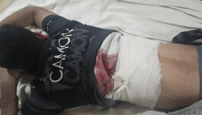 নোয়াখালীতে ব্যবসায়ীকে গুলি করে মোটরসাইকেল ছিনতাই