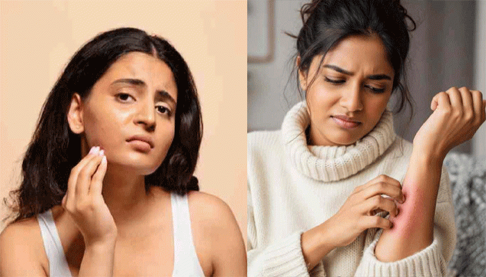 শীতের সময়ে এই অভ্যাসগুলিই ত্বকের শুষ্কতা দ্রুত বাড়িয়ে দেয়