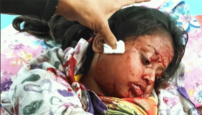 মিয়ানমার সীমান্ত থেকে ছোড়া গুলিতে টেকনাফে প্রাণ গেল শিশুর