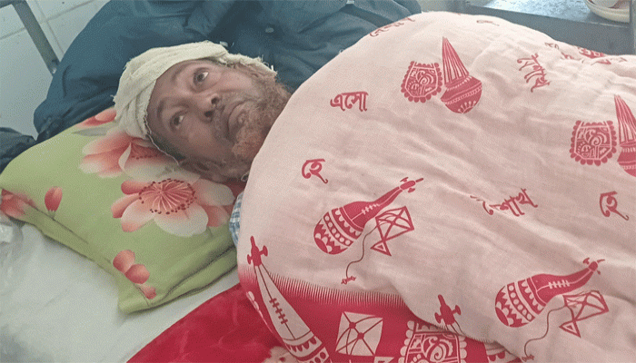 তানোরে সম্পত্তি নিয়ে বিরোধ একজনকে কুপিয়ে জখম