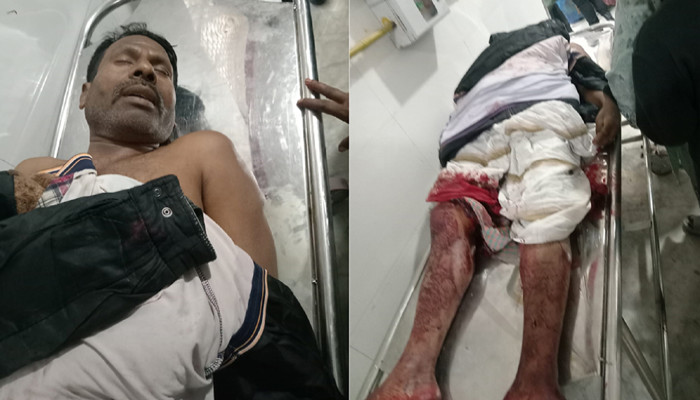 মতিহারে প্রতিপক্ষের গুলিতে কোল্ড স্টোরেজ শ্রমিক নিহত, এলাকায় উত্তেজনা
