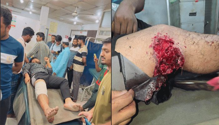 বাড়ির সামনে জামায়াত কর্মী গুলিবিদ্ধ